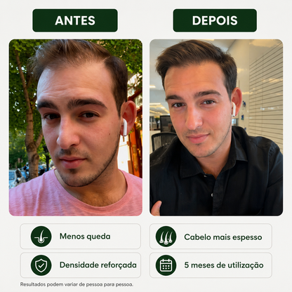 Sérum Capilar Bio Densyl