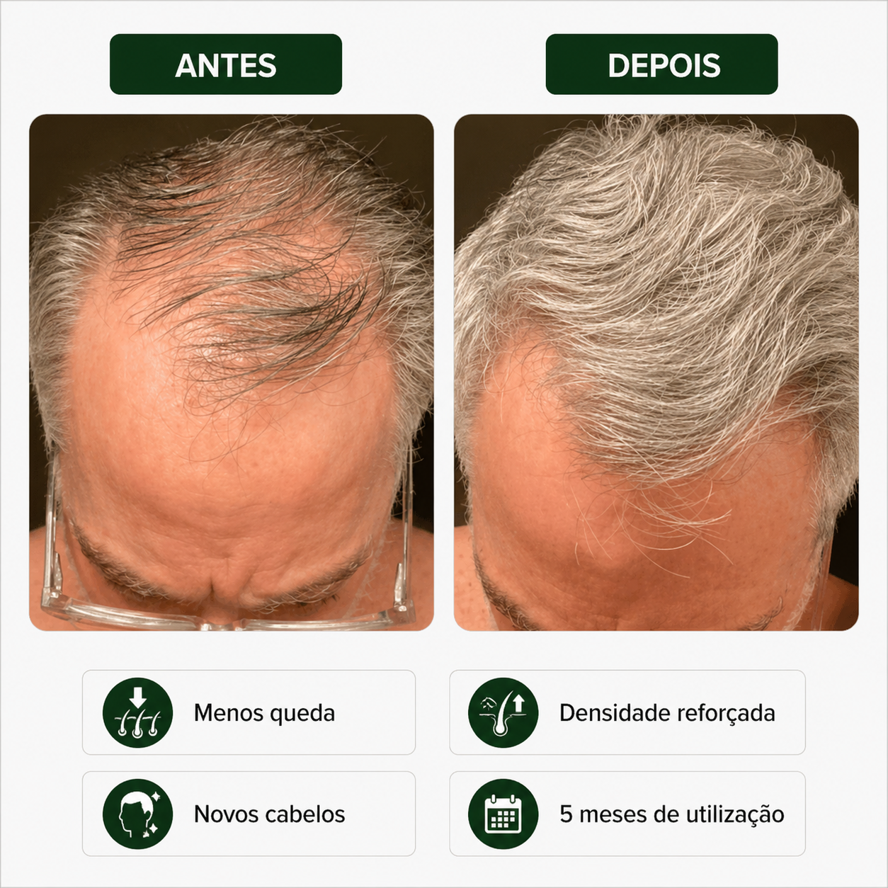 Sérum Capilar Bio Densyl